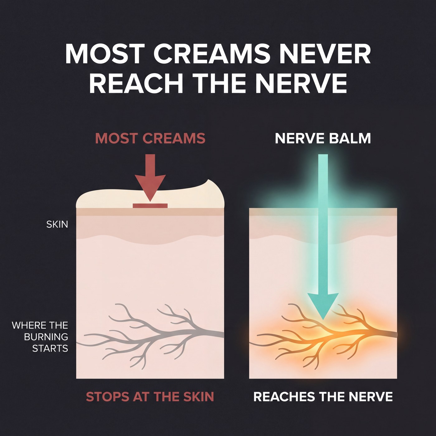 Cross-section titled Most Creams Never Reach The Nerve, one cream stopping at the skin while Nerve Balm reaches the nerve below