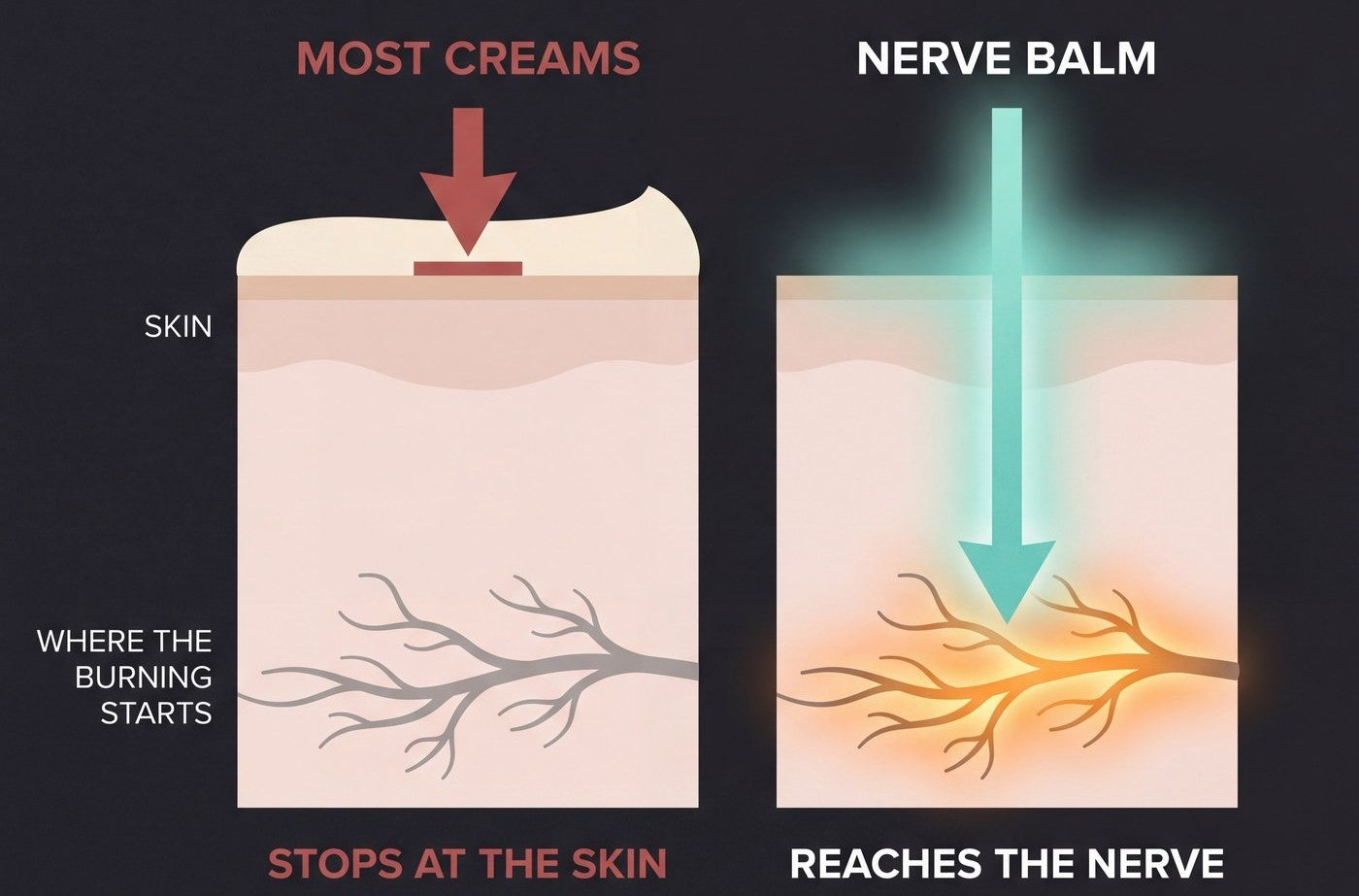 Cross-section diagram: most creams stopping at the skin, Nerve Balm carried down to the nerve below
